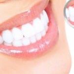 Diş hastalıklarıyla ilgili doğru bilinen yanlışlar