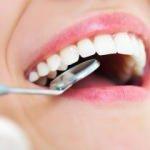 Diş Eksikliğinin 8 önemli zararı