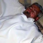 Celal Kılı&ccedil;daroğlu a&ccedil;lık grevine başladı