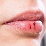 4 adımda sağlıklı dudaklara kavuşun