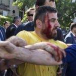 Washington'da T&uuml;rklere al&ccedil;ak saldırı!