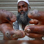 Dev elleri y&uuml;z&uuml;nden iş bulamıyor!