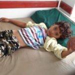 Yemen'de kolera salgını tüm ülkeye yayıldı