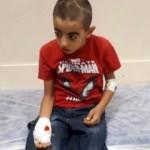 9 yaşındaki çocuğun eline şiş saplandı
