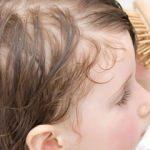 Çocuklarda kepek saç tedavisi