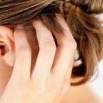 Bitler saçtan nasıl temizlenir?