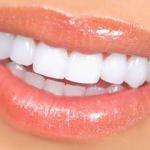 Doğal diş beyazlatma yöntemleri