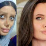 Angelina Jolie'ye benzemek istedi ama...	