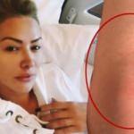 Ünlü şarkıcı klip çekiminde kaza geçirdi!