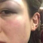 Genç kadından şok iddia! Demir çubukla dövdü