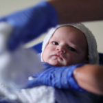 Mavi bebek sendromu hastalığı nedir? Belirtileri neler?