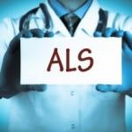 ALS hastalığı nedir? ALS belirtileri nelerdir, tedavisi mümkün müdür?