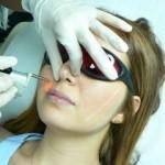 Lazer epilasyonu zararlı mıdır?