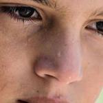 Yüz terlemesi nedir? Sebepleri nelerdir?