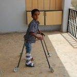 Eyyübiye Belediyesinden engelli çocuğa destek