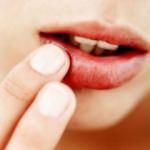 Dudak çatlamasına ne iyi gelir?