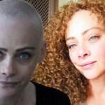 Oyuncu Dilek Serbest'in saçlarına ne oldu?