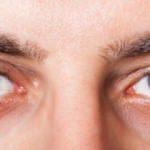 Göz kanseri nedir? Belirtileri nelerdir ve tedavisi var mıdır?