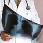 Uzmanlar açıkladı! Akciğer kanseri ölümlerinde artış