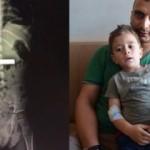 Küçük çocuğun röntgeni doktorları şaşkına çevirdi