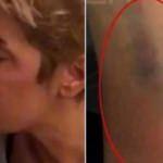 Sıla'nın darp raporunda korkunç detaylar: İdrarında kanama...