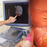 Bebeklerde ilk hangi organ gelişir? Hafta hafta bebek gelişimi