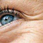 Kaz ayağı kırışıkları için etkili yöntemler