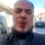 İzmir'de gazeteciye darp iddiası
