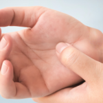 Elde kistinin (Ganglion) belirtileri var mıdır? El kistinin tedavi yöntemi nedir?