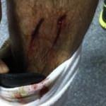 Konyaspor'dan dev isyan! Ayağı bu halde