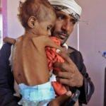 Yemen trajedisi: Para için 3 yaşındaki çocuklarını satmaya başladılar