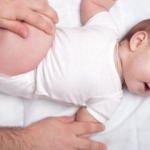 Bebeklerde kalça çıkıklığı nasıl anlaşılır?