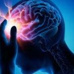 Beyin anevrizma nedir ve belirtileri nelerdir? Beyin anevrizmanın tedavisi var mıdır?