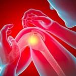 Diz çıkması neden olur? Diz çıkmasının belirtileri nelerdir ve tedavisi var mıdır?