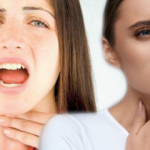 Ses kısıklığı neden olur? Ses kısıklığına iyi gelen doğal yollar nelerdir?