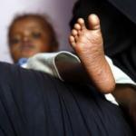 Yemen'deki savaşta ellerini kaybeden k&uuml;&ccedil;&uuml;k kız: Resim tutkumdu