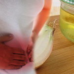 Polikistik over sendromu neden olur? Polikistik over sendromu belirtileri nelerdir?