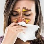 Alerjik rinit nedir? Alerjik rinit belirtileri nelerdir? Alerjlk rinitin tedavisi var mı?