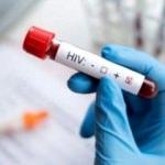 İran'da sağlık skandalı: 300 kişiye HIV bulaştırdı!