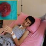 Şaşkına döndüler! 14 yaşındaki çocuğun böbreğinden çıktı