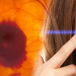 Sarı nokta hastalığı nedir? Sarı nokta hastalığının belirtileri nelerdir?