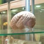 Beyin implantları hafızayı yüzde 20 arttırıyor