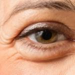 Göz altı torbaları nasıl geçer? Göz altı torbaları için en iyi 10 krem