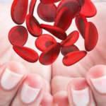 Akdeniz anemisi (Talasemi) nedir? Akdeniz anemisi belirtileri nelerdir? Akdeniz anemisi tedavi