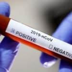 Spor federasyonlarında koronavirüs tedirginliği