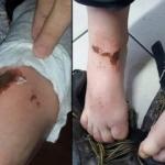 Çocuklar kartopu oynarken olmuştu! Nedeni belli oldu