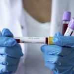 Almanya diken üstünde! Sayı giderek artıyor...