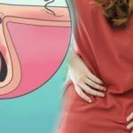 Kıl dönmesi neden olur? Kıl dönmesi belirtileri nelerdir? Kıl dönmesinin doğal tedavisi var mı?