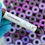 Dünyanın beklediği 'koronavirüs aşısı' haberi geldi: Denemeye başladık