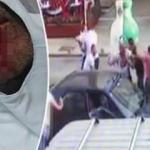 Kayınpederinin dudağını ısırıp kopardı! İşte istenen ceza